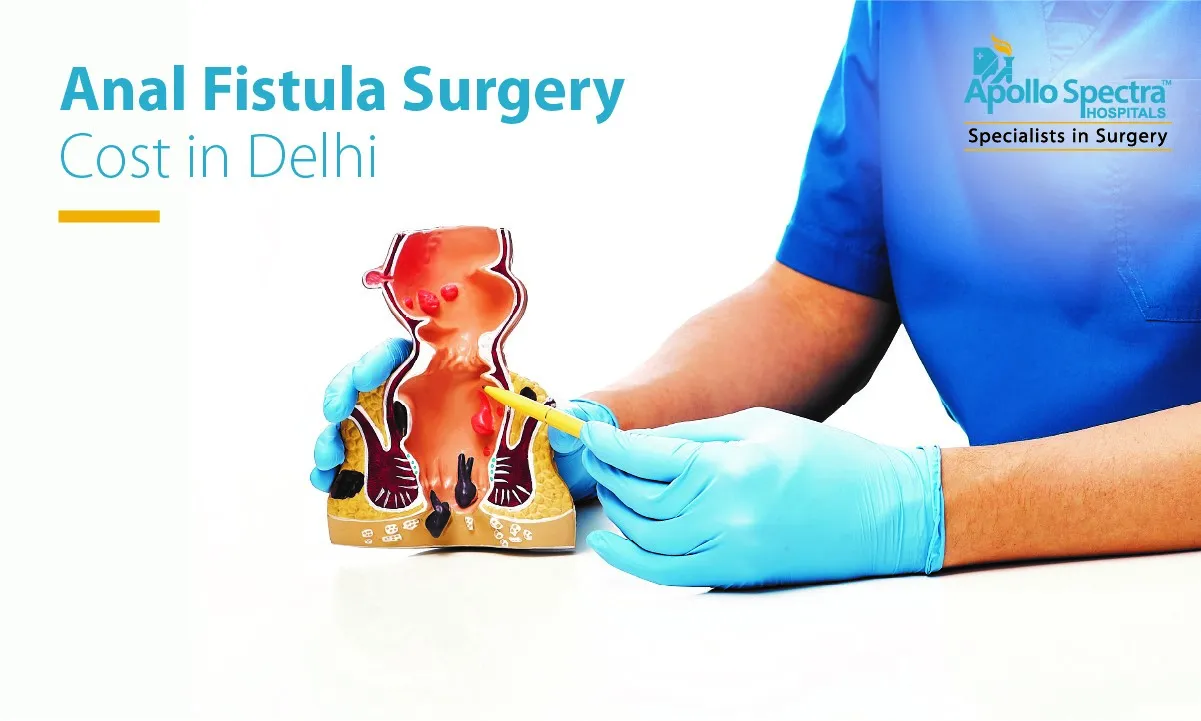 Anal Fistula Surgery Cost in Delhi